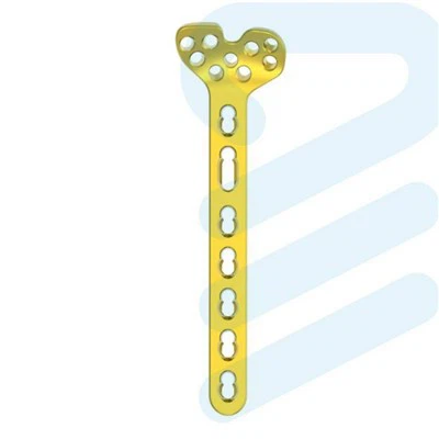 Distaalinen säde muuttuva kulmalevy